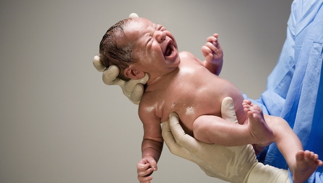 【研究】预产期催产降低胎儿死亡风险 “打人不打脸”有了依据