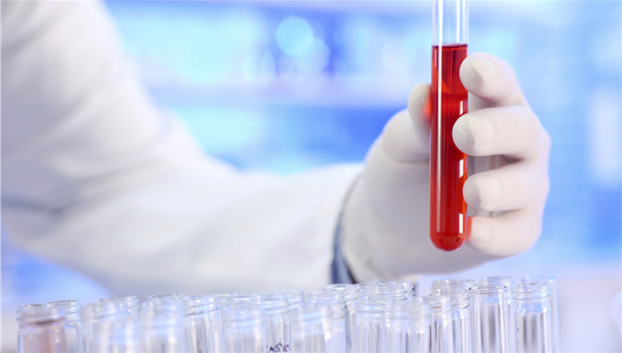 33.6亿元高溢价收购血液制品资产 天坛生物要当行业老大