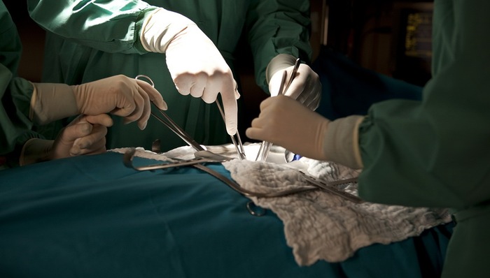 天下故事,惊奇的发现