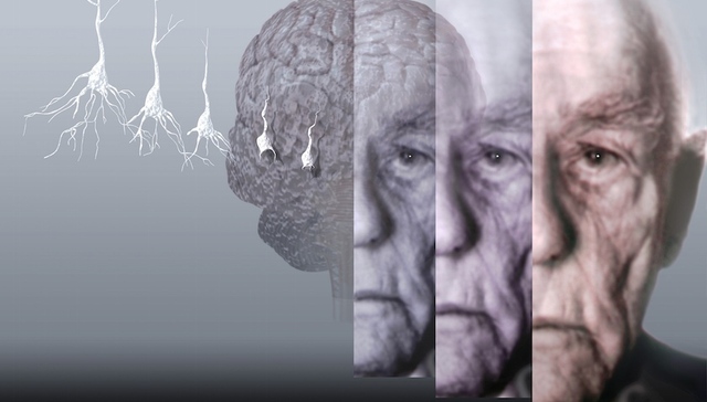 【研究】老年痴呆有望提前被检测出 人类因争夺配偶进化出“男流感”