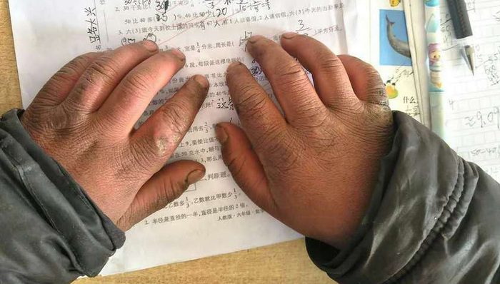 冰花男孩,贫困儿童,盈科律师,祖传膏药,中学生斗殴,留置措施