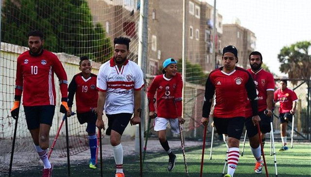 虽然只有一条腿 他们仍梦想加入“世界杯”