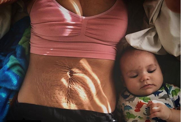 她们露出妊娠纹，只为让你知道产后的真实状态