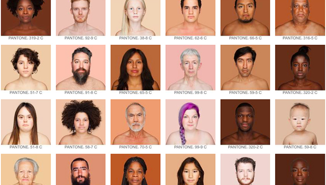 【一周影像资讯】4000张照片告诉你：人类到底有多少种肤色？奇异的上世纪初医疗影像