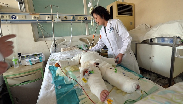 幼儿园,开水烫伤,教育局