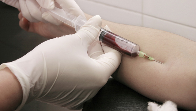 香港大学成功研发预防和清除艾滋病病毒新药物