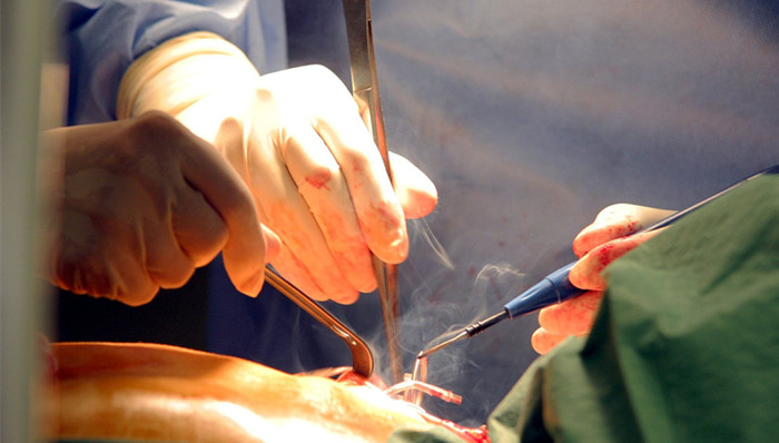 卖肾,高利贷,尿毒症