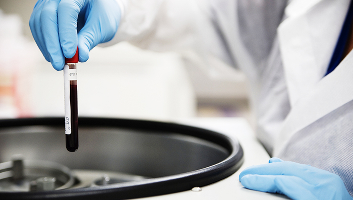 支付宝,脐带血干细胞,脐带血库,第三产程,种子,移植物抗宿主病,土壤,小微,中性粒细胞,脐带血造血干