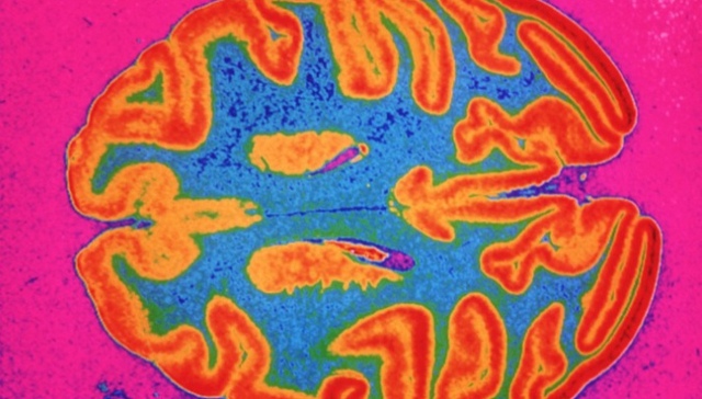 “无性别的大脑”：别再执着于寻找男性和女性大脑的不同之处了