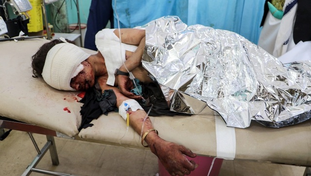 外媒：沙特联军空袭也门胡塞武装 击中儿童巴士致数十死