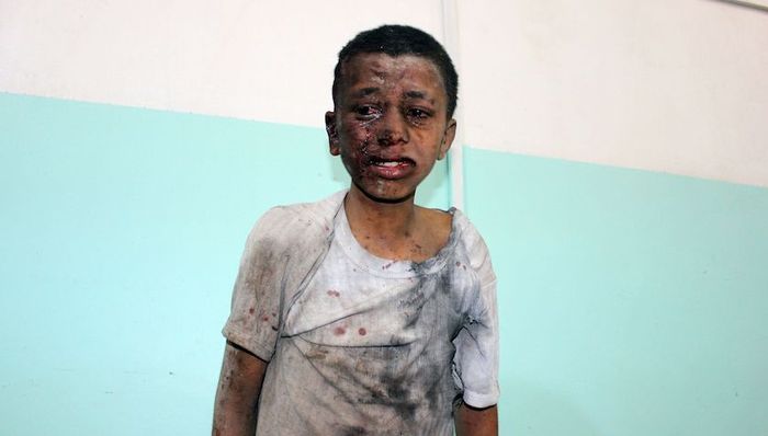 也门,空袭,校巴