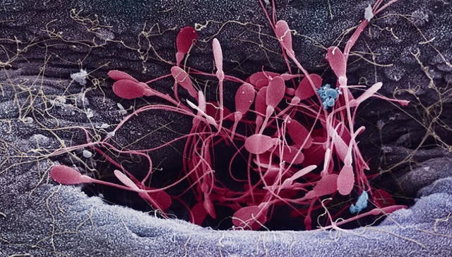 精子竞赛：又是一个关于人类生殖的男性幻想