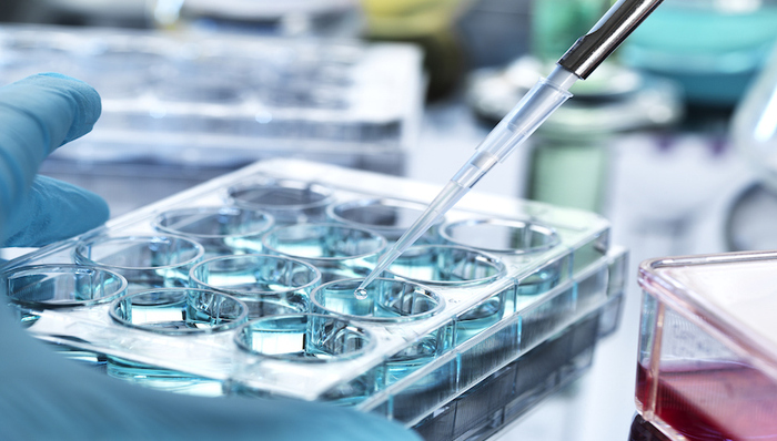 医药研发新动态|新研究称阑尾切除可降低帕金森病风险