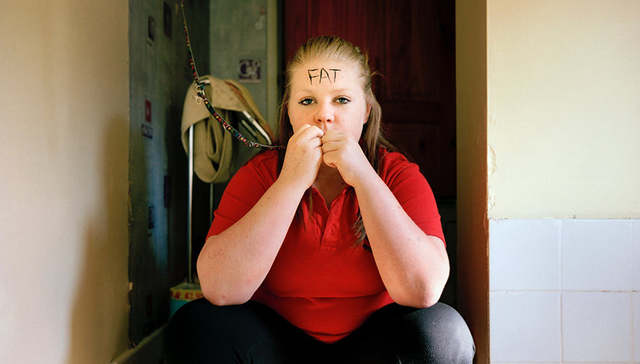 青少年肥胖之重