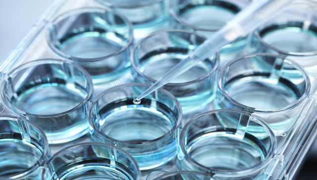 干细胞严监管下乱象犹存 药物开发缓慢灰色治疗难除