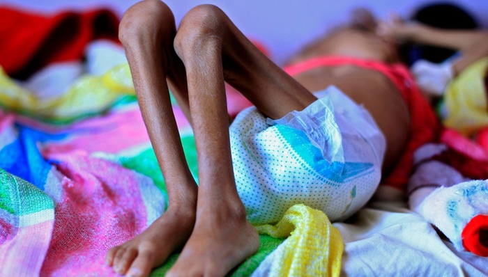 也门,粮食,饥荒,和谈