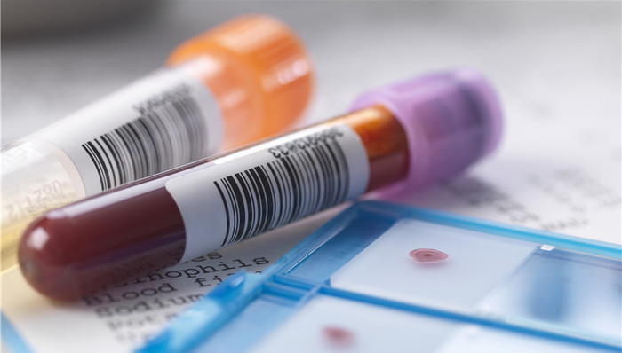 华兰生物,上海莱士,跌停,辅助用药