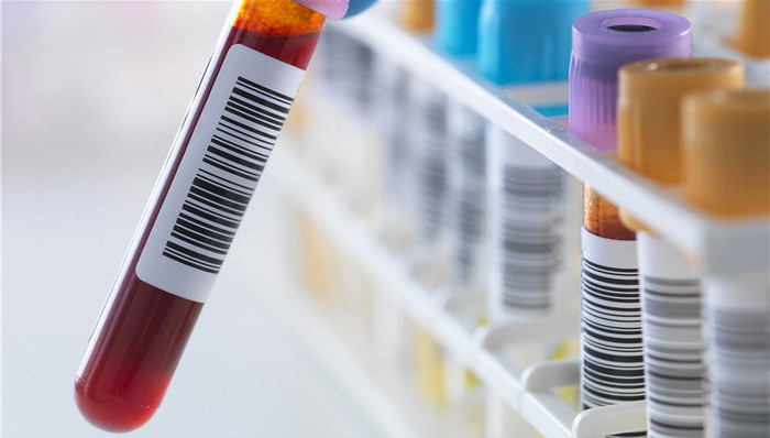 振兴生化,管理,佳兆业