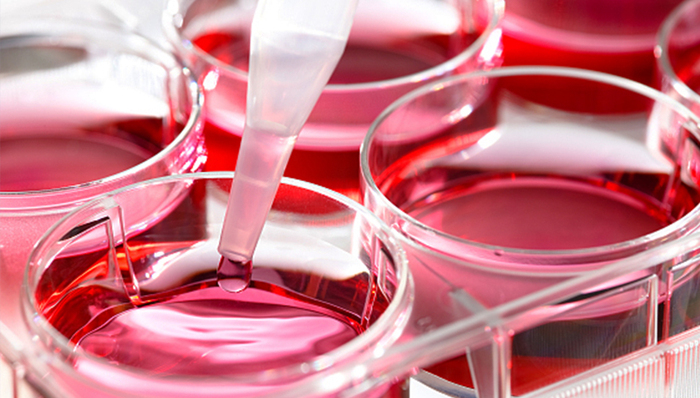 美国科研机构创新大B细胞淋巴瘤治疗技术有望引入国内