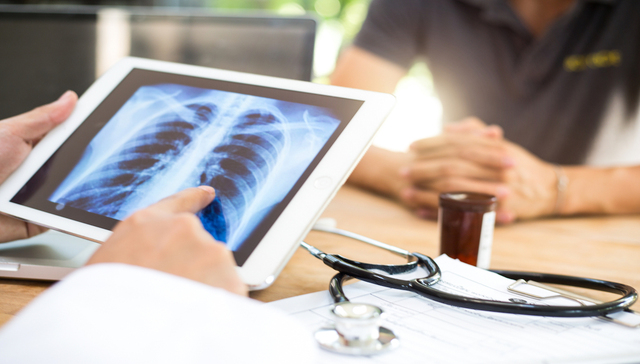 全球第一死亡率的癌症有望实现早期筛查