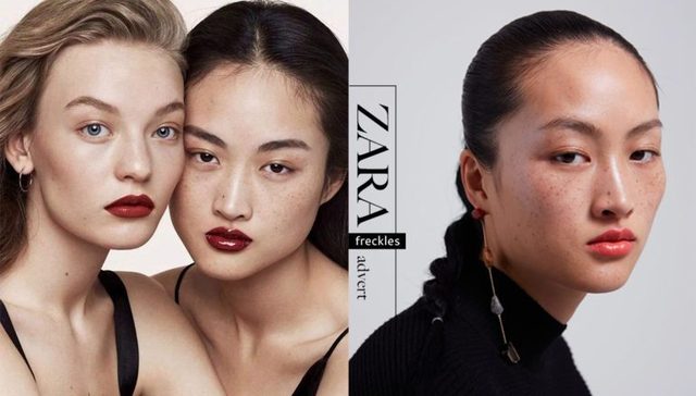百年雀斑史，美丑一念间：从ZARA广告涉嫌“辱华”谈起
