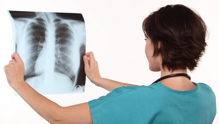 肺结核,医保,痨病