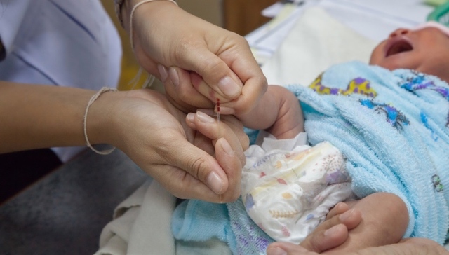 地中海贫血,地贫,出生缺陷