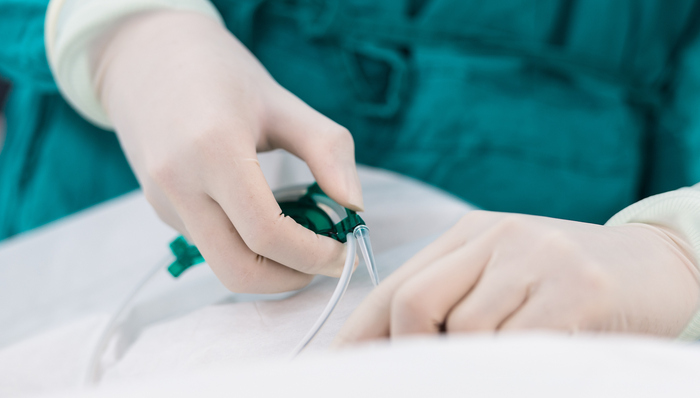 博士生举报导师乱装支架收取回扣，介入支架仍属灰色地带