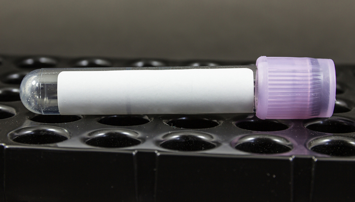 江苏东台一医院69人院内感染丙肝，医院书记院长被免职