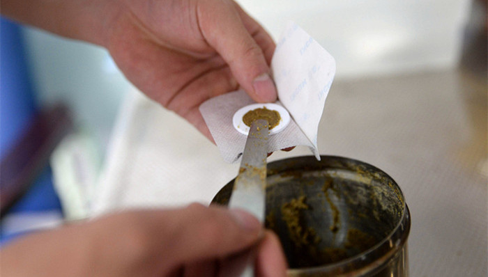 江西省儿童医院,三伏贴