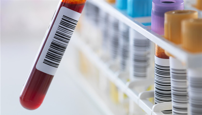 上海莱士,扭亏,商誉