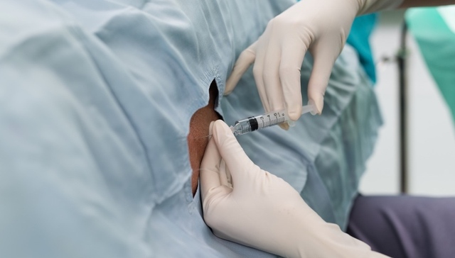 国家卫健委：今年将在900余家医院开展无痛分娩试点