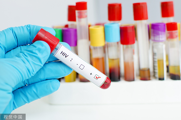 近20年以来科学家首次发现新的HIV毒株亚型