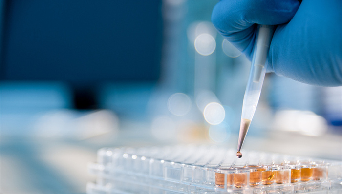 北京确认接诊鼠疫病例，什么是鼠疫？