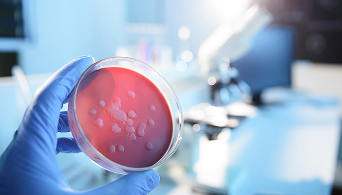 【界面晚报】中国疾控中心发文称鼠疫可控可治 银保监会针对中小银行挤兑风波再发声