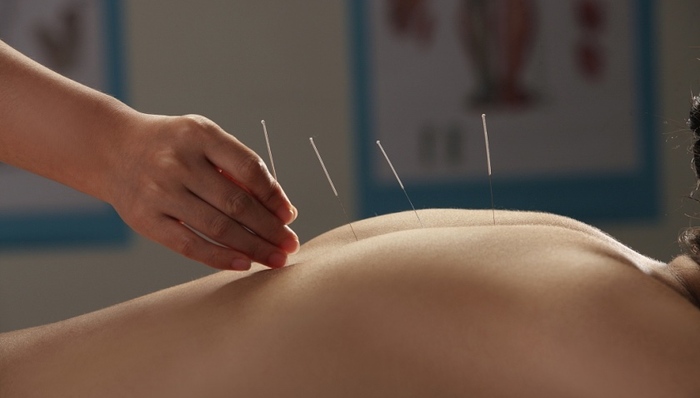 河南115人针灸后感染：针灸针复用存在哪些风险？