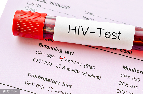 【特写】HIV检测之争：选择尿检还是血检？