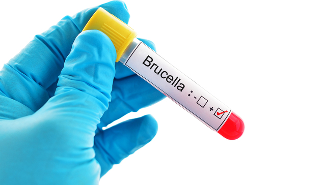 疫苗,医药,布病,兰州,甘肃,上市公司,股票,长生生物