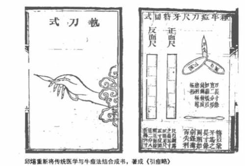 疫苗的历史：种痘技术19世纪如何传入中国