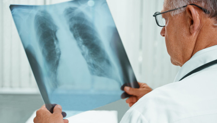 冠状病毒,肺炎,确诊,病例,境外,WHO