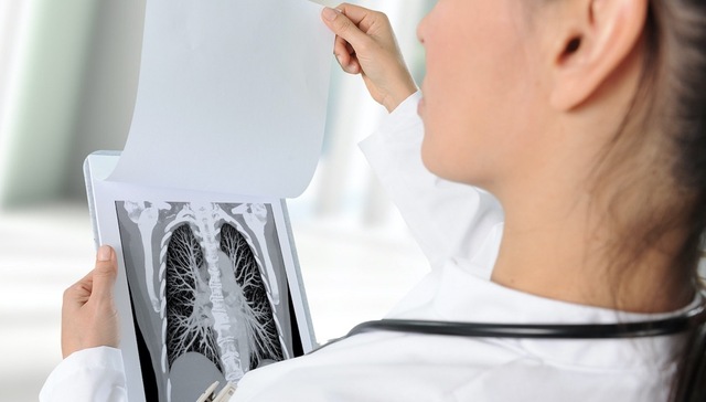 争议！CT与核酸检测哪个更靠谱？