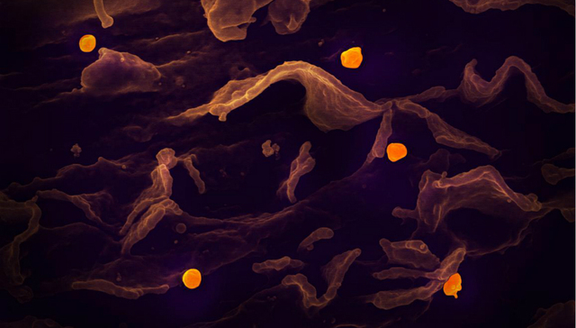 新型冠状病毒肺炎,药物研发,瑞德西韦,专利,武汉病毒所