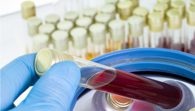 血浆治疗是否有风险？金银潭医院院长：风险远小于获益