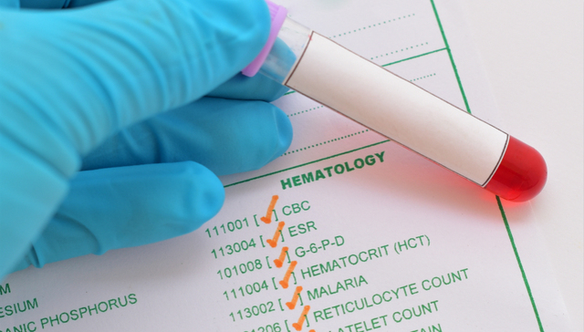 新型冠状病毒肺炎,疫情防控,血清疗法