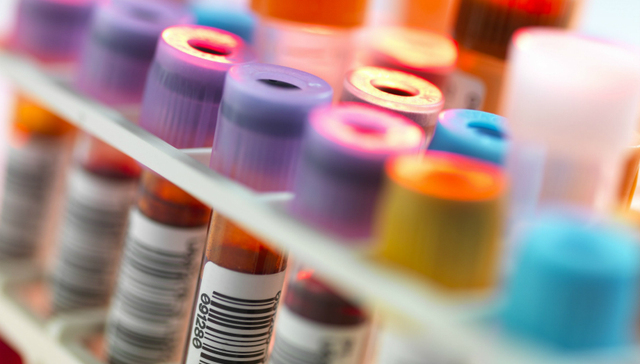 新型冠状病毒肺炎,疫情防控,临床试验,药物研发