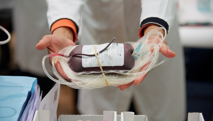 新冠治愈者血浆量小治疗效率低，那么特异性免疫球蛋白呢？