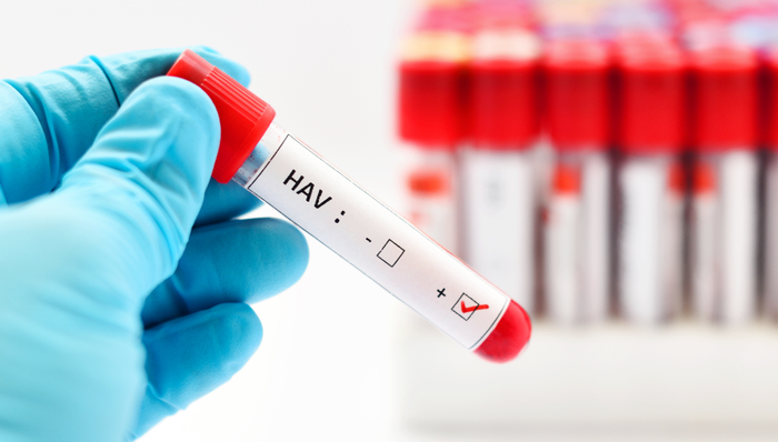 大连回应甲肝病例增多：呈下降趋势，或为食源性导致