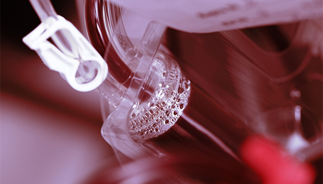 出血热，疫情，复工