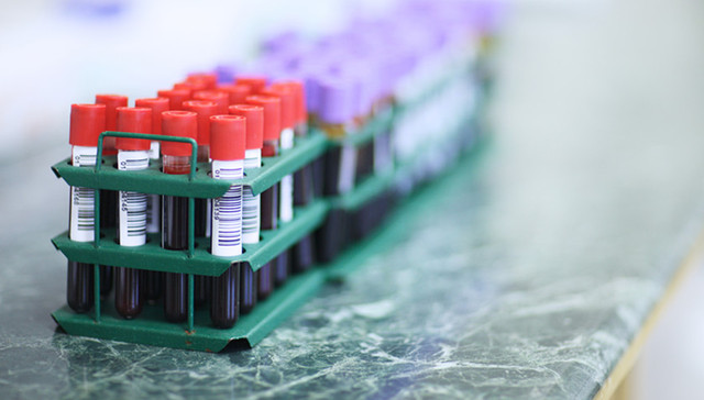 中国9个省市开展无症状感染者血清流行病学调查，武汉将抽样1.1万人次