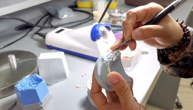 假牙,医疗,消费